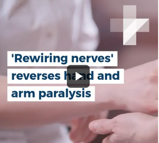 ​'Rewiring nerves' reverses hand and arm paralysis