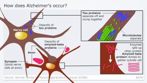 Amyloid Beta And Tau